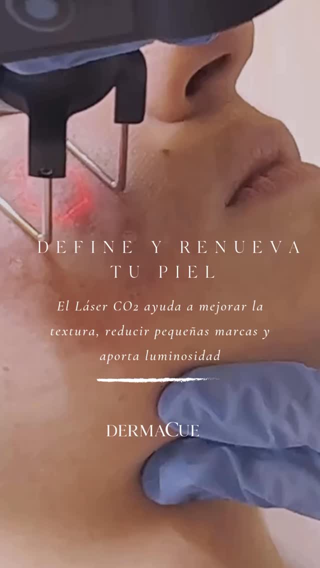✨ Define, renueva y realza tu piel con Láser CO2 ✨
El Láser CO2 ayuda a mejorar la textura, reducir pequeñas marcas y aportar luminosidad a la piel, consiguiendo un acabado más uniforme y saludable.
En DERMACUE, este tratamiento se realiza exclusivamente por MÉDICOS DERMATÓLOGOS, asegurando la máxima precisión y seguridad para tu piel.
💫 Ideal para quienes buscan una piel más suave, radiante y llena de vida.
DERMACUE — Dermatología Médica, Ética y Estética
#Dermacue #LaserCO2 #PielRadiante #Dermatologia #CuidatuPiel #MedicosDermatologos #GlowSkin #TratamientosFaciales #DermatologiaMedica #PielJoven