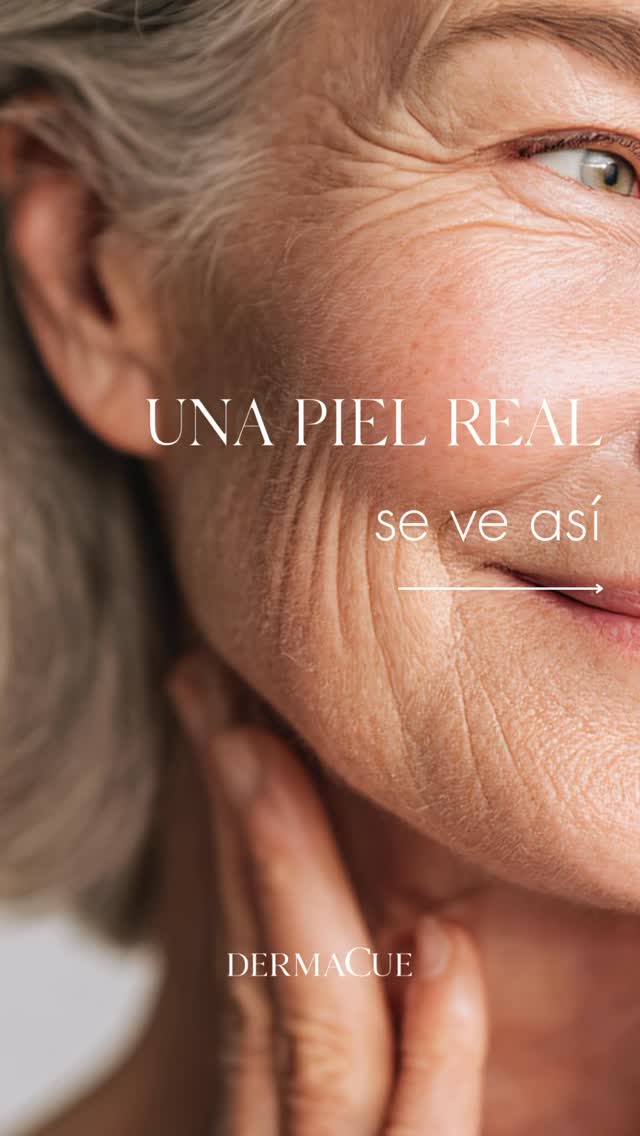 La piel real tiene poros, manchas y líneas de expresión, y eso está bien. Lo importante es cómo la cuidamos cada día: con limpieza, hidratación y protección. En DERMACUE, con tratamientos realizados por nuestros MÉDICOS DERMATÓLOGOS, acompañamos tu rutina para potenciar la salud y la belleza natural de tu piel. Porque una piel cuidada refleja bienestar y confianza. ✨
DERMACUE — Dermatología Médica, Ética y Estética
#DERMACUE #LaserCO2 #PielRadiante